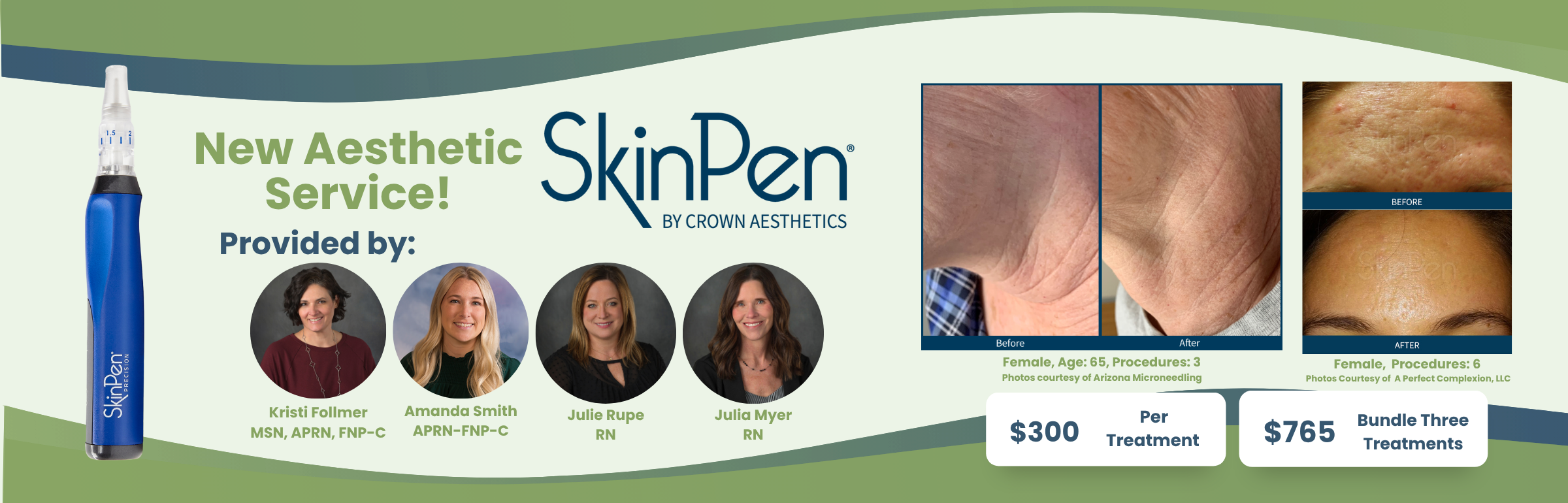 SkinPen 